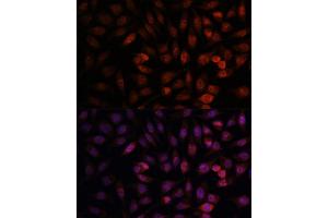 Immunofluorescence analysis of L929 cells using DDX24 antibody (ABIN7266691) at dilution of 1:100. (DDX24 Antikörper  (AA 510-859))