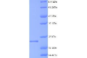 CAPSD (AA 1-183), (full length) protein (His tag)