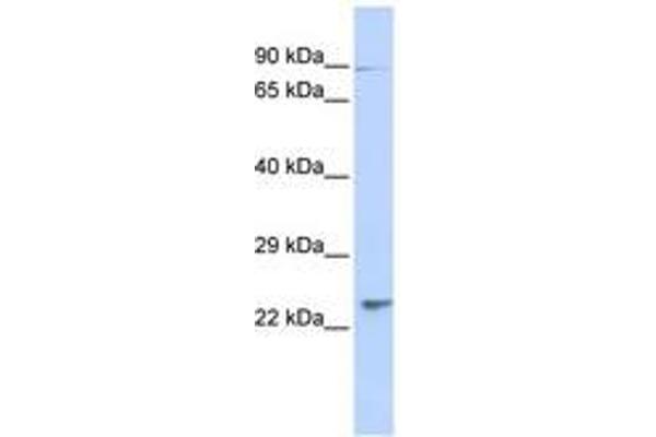 Leucine Rich Transmembrane and 0-Methyltransferase Domain Containing (LRTOMT) (N-Term) Antikörper