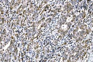 IHC analysis of RAD18 using anti-RAD18 antibody (ABIN7599364). (RAD18 Antikörper  (AA 1-408))