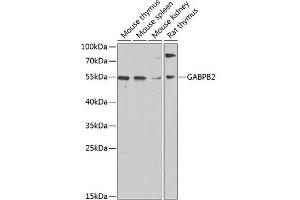 Western blot analysis of extracts of various cell lines, using G antibody (ABIN6130410, ABIN6140895, ABIN6140896 and ABIN6220279) at 1:1000 dilution. (GABPB2 Antikörper  (AA 239-448))