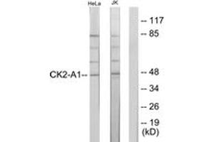 Western blot analysis of extracts from HeLa/Jurkat cells, using Casein Kinase II alpha (Ab-255) Antibody. (CSNK2A1/CK II alpha Antikörper  (AA 221-270))