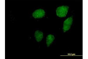 Immunofluorescence of purified MaxPab antibody to VCX3A on HeLa cell. (VCX3A Antikörper  (AA 1-166))
