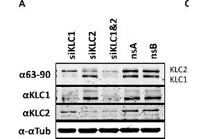 The effect of KLC knock-down by siRNA on virus egress. (KLC1 Antikörper)
