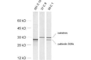 dilution: 1 : 1000, sample: rat brain homogenate (Calbindin D28k/D29k Antikörper)