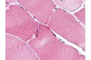 Immunohistochemistry of ARC in human heart tissue (A) and skeletal muscle (B) with ARC antibody at 5 μg/ml. (NOL3 Antikörper  (C-Term))