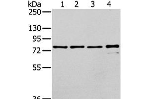 Western Blot analysis of Raji, K562, skov3 and pc3 cell using GHR Polyclonal Antibody at dilution of 1/400 (Growth Hormone Receptor Antikörper)