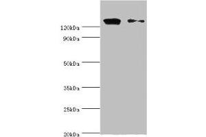 Western blot All lanes: CCAR1 antibody at 10 μg/mL Lane 1: Hela whole cell lysate Lane 2: PC-3 whole cell lysate Secondary Goat polyclonal to rabbit IgG at 1/10000 dilution Predicted band size: 133, 132 kDa Observed band size: 133 kDa (CCAR1 Antikörper  (AA 1-200))
