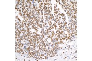 Immunohistochemistry (IHC) image for anti-Heterogeneous Nuclear Ribonucleoprotein K (HNRNPK) (C-Term) antibody (ABIN7454660) (HNRNPK Antikörper  (C-Term))