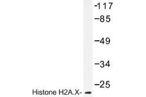 Image no. 1 for anti-H2A Histone Family, Member X (H2AFX) antibody (ABIN317781) (H2AFX Antikörper)