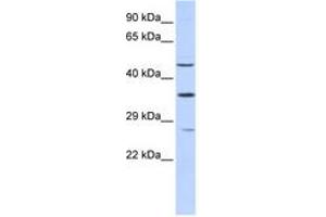 Image no. 1 for anti-Myocyte Enhancer Factor 2B (MEF2B) (N-Term) antibody (ABIN6742793) (MEF2B Antikörper  (N-Term))