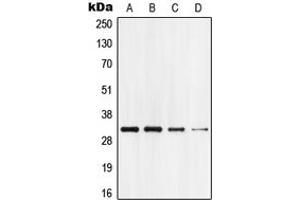 Western blot analysis of GPR18 expression in HEK293T (A), Jurkat (B), mouse brain (C), rat brain (D) whole cell lysates. (GPR18 Antikörper  (Center))