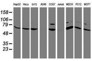 Image no. 12 for anti-F-Box Protein 21 (FBXO21) antibody (ABIN1498234)