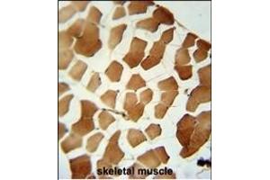 P6C Antibody (C-term) (ABIN6242920 and ABIN6579047) immunohistochemistry analysis in formalin fixed and paraffin embedded human skeletal muscle followed by peroxidase conjugation of the secondary antibody and DAB staining. (PPP6C Antikörper  (C-Term))