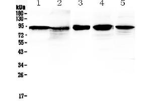 Western blot analysis of beta Catenin using anti-beta Catenin antibody .