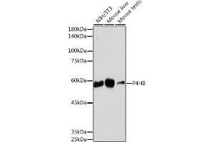 Western blot analysis of extracts of various cell lines, using P4HB antibody (ABIN7269560) at 1:1000 dilution. (P4HB Antikörper)
