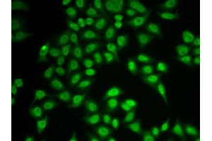 Immunofluorescence analysis of MCF-7 cells using PSMB9 antibody.