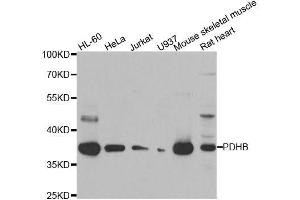 Western blot analysis of extracts of various cell lines, using PDHB antibody. (PDHB Antikörper  (AA 1-300))
