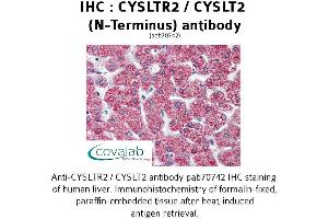 Image no. 1 for anti-Cysteinyl Leukotriene Receptor 2 (CYSLTR2) (N-Term) antibody (ABIN1733466) (CasLTR2 Antikörper  (N-Term))