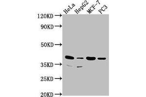 Western Blot Positive WB detected in: Hela whole cell lysate, HepG2 whole cell lysate, MCF-7 whole cell lysate, PC3 whole cell lysate All lanes: DUSP11 antibody at 1:2000 Secondary Goat polyclonal to rabbit IgG at 1/50000 dilution Predicted band size: 39, 26 kDa Observed band size: 39 kDa (DUSP11 Antikörper  (AA 105-377))