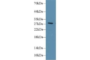 Western Blot; Sample: Rat Blood Cells lysate; Primary Ab: 1µg/ml Rabbit Anti-Rat DIO3 Antibody Second Ab: 0. (DIO3 Antikörper  (AA 37-169))