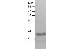 Western Blotting (WB) image for Hemoglobin, zeta (HBZ) (AA 1-142) protein (His tag) (ABIN7285045) (HBZ Protein (AA 1-142) (His tag))