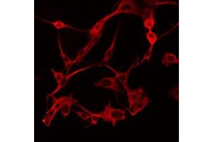 ABIN6274791 staining COLO205 by IF/ICC. (ABHD6 Antikörper  (Internal Region))