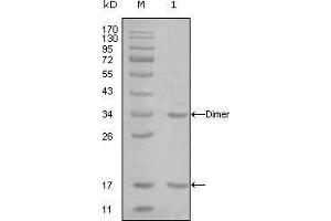 Western Blot showing EP300 antibody used against truncated EP300-His recombinant protein (1). (p300 Antikörper)