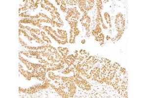 Immunohistochemistry (IHC) image for anti-Tripartite Motif Containing 28 (TRIM28) (AA 650-700) antibody (ABIN7453436)