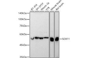 Western blot analysis of extracts of various cell lines, using SOX11 antibody (ABIN7270569) at 1:1000 dilution. (SOX11 Antikörper)