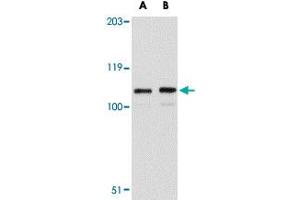 Western blot analysis of LRFN3 in K-562 cell lysate with LRFN3 polyclonal antibody  at (A) 1 and (B) 2 ug/mL . (LRFN3 Antikörper  (Internal Region))