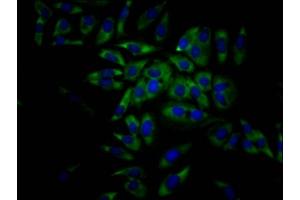 Immunofluorescence staining of Hela Cells with ABIN7127468 at 1:50, counter-stained with DAPI. (Rekombinanter EIF4A1 Antikörper)