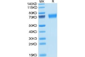 SDS-PAGE (SDS) image for AXL Receptor tyrosine Kinase (AXL) (AA 20-445) protein (His tag) (ABIN7273886)