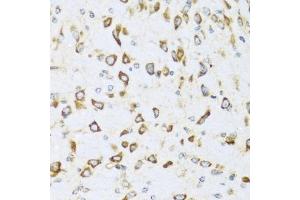 Immunohistochemistry (IHC) image for anti-Neuregulin 4 (NRG4) (AA 1-115) antibody (ABIN3016310)