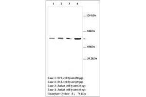 Image no. 1 for anti-Guanylate Cyclase 1, Soluble, beta 3 (GUCY1B3) (AA 188-207) antibody (ABIN791333) (GUCY1B3 Antikörper  (AA 188-207))