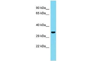 Host: Rabbit Target Name: CCDC75 Sample Type: Fetal Kidney lysates Antibody Dilution: 1. (CCDC75 Antikörper  (N-Term))