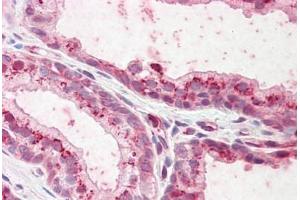Human Prostate: Formalin-Fixed, Paraffin-Embedded (FFPE) (Plakophilin 2 Antikörper  (AA 125-139))
