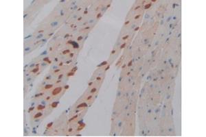 IHC-P analysis of Mouse Heart Tissue, with DAB staining. (PD-L1 Antikörper  (AA 48-290))