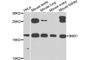 Western blot analysis of extracts of various cell lines, using B9D1 antibody (ABIN5975680) at 1/1000 dilution. (B9D1 Antikörper)