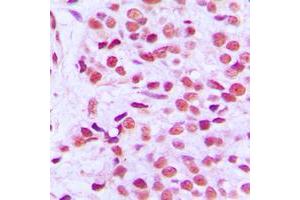 Immunohistochemistry (IHC) image for anti-V-Ets erythroblastosis Virus E26 Oncogene Homolog 1 (Avian) (ETS1) (N-Term), (pSer38) antibody (ABIN7295616)