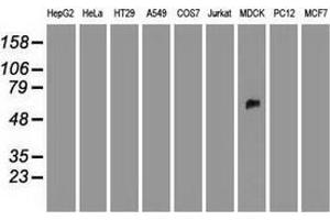 Western blot analysis of extracts (35 µg) from 9 different cell lines by using anti-SILV monoclonal antibody. (Melanoma gp100 Antikörper)