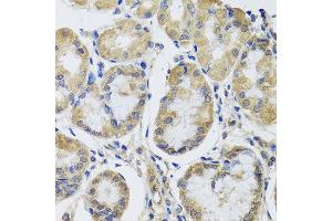 Immunohistochemistry of paraffin-embedded human gastric using MRPL1 antibody at dilution of 1:100 (x40 lens). (MRPL1 Antikörper)