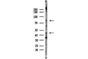 Western blot analysis of lysates from HepG2 cells(starvation,24h treatment), using MDM2 Antibody at 1/1000 dilution.