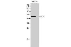 Western Blotting (WB) image for anti-Protein Phosphatase, Mg2+/Mn2+ Dependent, 1L (PPM1L) (Internal Region) antibody (ABIN3186533) (PPM1L Antikörper  (Internal Region))
