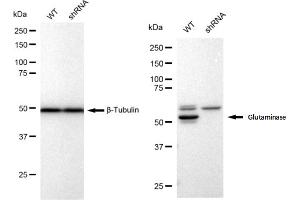 Western blotting analysis using Glutaminase antibody (ABIN7798747).