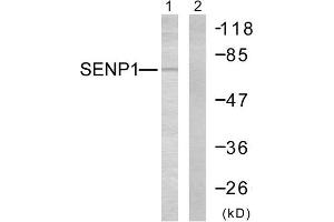 Western Blotting (WB) image for anti-SUMO1/sentrin Specific Peptidase 1 (SENP1) (N-Term) antibody (ABIN1848840) (SENP1 Antikörper  (N-Term))