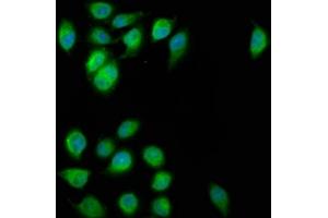 Immunofluorescence staining of A549 cells with ABIN7152326 at 1:200, counter-stained with DAPI. (FAM62B Antikörper  (AA 567-736))