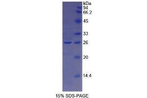 SDS-PAGE analysis of Human TFR2 Protein. (Transferrin Receptor 2 Protein (TFR2))
