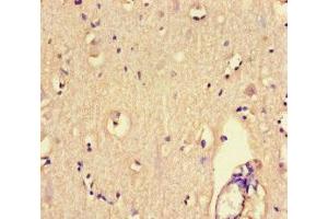 Immunohistochemistry of paraffin-embedded human brain tissue using ABIN7167518 at dilution of 1:100