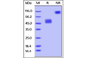 SDS-PAGE (SDS) image for Tumor Necrosis Factor Receptor Superfamily, Member 13C (TNFRSF13C) (AA 10-71) (Active) protein (Fc Tag,AVI tag,Biotin) (ABIN4949050)